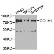 Western blot analysis of extracts of various cell lines, using GOLM1 antibody (abx005490) at 1/1000 dilution.