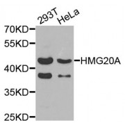 Western blot analysis of extracts of various cell lines, using HMG20A antibody (abx005493) at 1/1000 dilution.