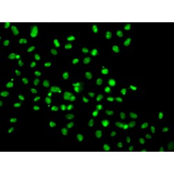 High Mobility Group Protein 20A (HMG20A) Antibody