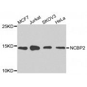 Western blot analysis of extracts of various cell lines, using NCBP2 antibody (abx005500) at 1/1000 dilution.