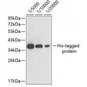 Western blot analysis of over-expressed His-tagged protein in 293T cell using His-tag antibody at different dilutions.