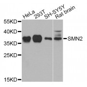 Western blot analysis of extracts of various cell lines, using SMN2 Antibody (abx005612) at 1/1000 dilution.