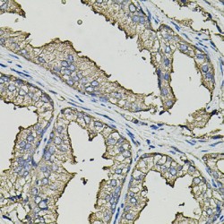 Survival Of Motor Neuron 2, Centromeric (SMN2) Antibody