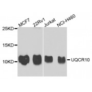 Western blot analysis of extracts of various cell lines, using UQCR10 antibody (abx005627) at 1/1000 dilution.