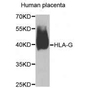Western blot analysis of extracts of human placenta, using HLA-G antibody (abx005635) at 1/1000 dilution.
