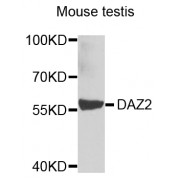 Western blot analysis of extracts of mouse testis, using DAZ2 antibody (abx005640) at 1/1000 dilution.