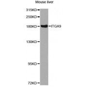 Western blot analysis of extracts of mouse liver, using ITGA9 antibody (abx005648) at 1/1000 dilution.