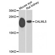 Western blot analysis of extracts of various cell lines, using CALML5 antibody (abx005656) at 1/1000 dilution.