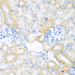 Carcinoembryonic Antigen Related Cell Adhesion Molecule 7 (CEACAM7) Antibody