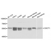 Western blot analysis of extracts of various cell lines, using OXCT1 antibody (abx005703) at 1:3000 dilution.