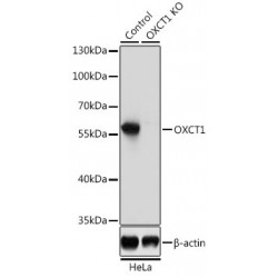 3-Oxoacid CoA-Transferase 1 (OXCT1) Antibody