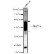Western blot analysis of MKN-45 cell lysates (25 μg per lane), using GPRC5A antibody (1/2000 dilution) followed by HRP-conjugated Goat Anti-Rabbit IgG H+L (<a href="https://www.abbexa.com/index.php?route=product/request&search=abx005548">abx005548</a>, 1/10000 dilution) and 3% non-fat dry milk in TBST for blocking.