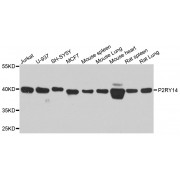 Western blot analysis of extracts of various cell lines, using P2RY14 antibody (abx005723) at 1/1000 dilution.