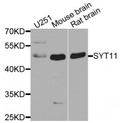 Western blot analysis of extracts of various cell lines, using SYT11 antibody (abx005730) at 1/1000 dilution.