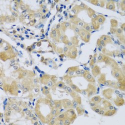 Synaptotagmin 11 (SYT11) Antibody
