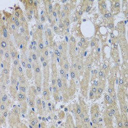 Synaptotagmin 11 (SYT11) Antibody