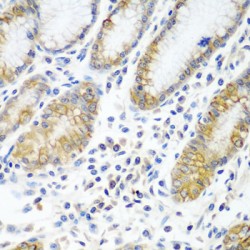 ATPase Family AAA Domain-Containing Protein 3A (ATAD3A) Antibody
