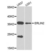 Western blot analysis of extracts of various cell lines, using ERLIN2 antibody (abx005795) at 1/1000 dilution.