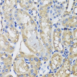 Mitochondrial Ribosomal Protein S22 (MRPS22) Antibody