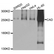 Western blot analysis of extracts of various cell lines, using CAD antibody (abx005800) at 1/1000 dilution.