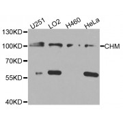 Western blot analysis of extracts of various cell lines, using CHM antibody (abx005801) at 1/1000 dilution.