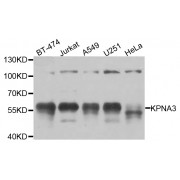 Western blot analysis of extracts of various cell lines, using KPNA3 antibody (abx005802) at 1/1000 dilution.