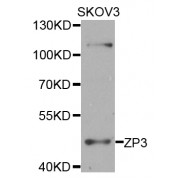 Western blot analysis of extracts of SKOV3 cells, using ZP3 antibody (abx005806) at 1/1000 dilution.