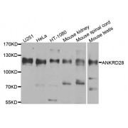 Western blot analysis of extracts of various cell lines, using ANKRD28 antibody (abx005810) at 1/1000 dilution.
