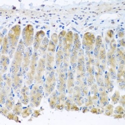 Phosphatidate Cytidylyltransferase, Mitochondrial (TAMM41) Antibody