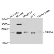 Western blot analysis of extracts of various cell lines, using RAB24 antibody (abx005821) at 1/1000 dilution.