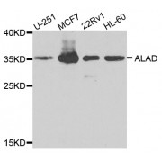 Western blot analysis of extracts of various cell lines, using ALAD antibody (abx005824) at 1/1000 dilution.