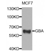 Western blot analysis of extracts of MCF-7 cells, using GBA antibody (abx005832) at 1/1000 dilution.