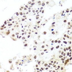 Histone Cell Cycle Regulator (HIRA) Antibody