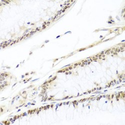 Histone Cell Cycle Regulator (HIRA) Antibody
