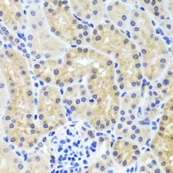InaD-Like Protein (INADL) Antibody
