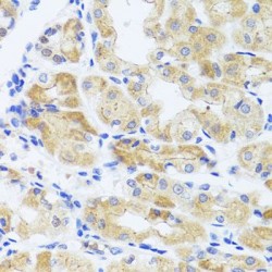 InaD-Like Protein (INADL) Antibody