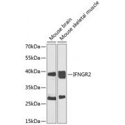 Western blot analysis of extracts of various cell lines, using IFNGR2 antibody (abx005877) at 1/1000 dilution.