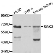 Western blot analysis of extracts of various cell lines, using SGK3 antibody (abx005881) at 1/1000 dilution.