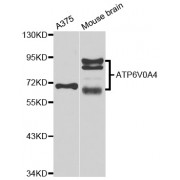 Western blot analysis of extracts of various cell lines, using ATP6V0A4 antibody (abx005882) at 1/1000 dilution.