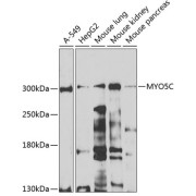 Western blot analysis of extracts of A-549 (Lane 1), HepG2 (Lane 2) cells, Mouse lung (Lane 3), kidney (Lane 4) and pancreas (Lane 5) tissues (25 µg per lane) using Unconventional Myosin-Vc Antibody (1/1000 dilution), followed by <a href="https://www.abbexa.com/index.php?route=product/search&search=abx005548" target="_blank">abx005548</a> - HRP-conjugated Goat Anti-Rabbit IgG, H+L antibody (1/10000 dilution) and 3% non-fat dry milk in TBST for blocking.