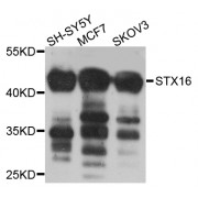 Western blot analysis of extracts of various cell lines, using STX16 antibody (abx005897) at 1/1000 dilution.