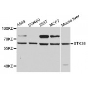 Western blot analysis of extracts of various cell lines, using STK38 antibody (abx005900) at 1/1000 dilution.