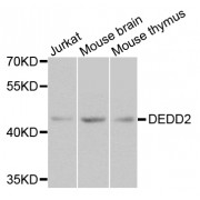 Western blot analysis of extracts of various cell lines, using DEDD2 antibody (abx005905) at 1/1000 dilution.
