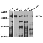Western blot analysis of extracts of various cell lines, using NUP214 antibody (abx005915) at 1/1000 dilution.