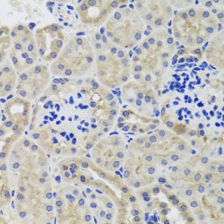 Hexokinase 3 (HK3) Antibody