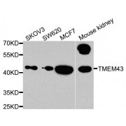 Western blot analysis of extracts of various cell lines, using TMEM43 antibody (abx005940) at 1/1000 dilution.