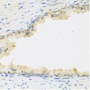 Immunohistochemistry of paraffin-embedded human prostate using LIF antibody (abx005951) at dilution of 1/100 (40x lens).