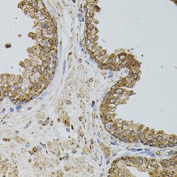 P-Selectin (SELP) Antibody