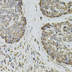 P-Selectin (SELP) Antibody