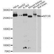 Western blot analysis of extracts of various cell lines, using MTOR antibody (abx005956) at 1/1000 dilution.